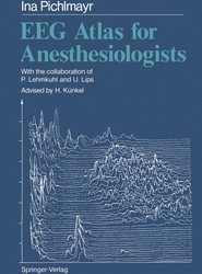 EEG Atlas for Anesthesiologists