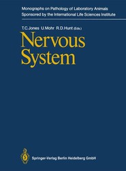 Nervous System