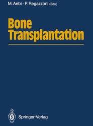 Bone Transplantation