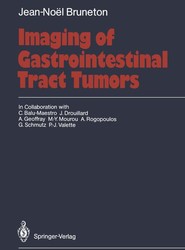 Imaging of Gastrointestinal Tract Tumors
