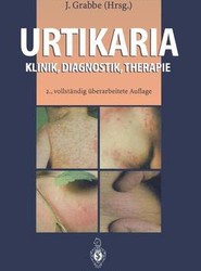 Urtikaria