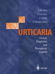 Urticaria