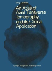 An Atlas of Axial Transverse Tomography and its Clinical Application