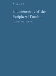 Biomicroscopy of the Peripheral Fundus