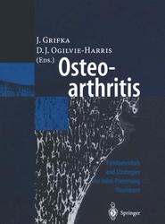 Osteoarthritis