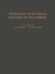 Technique of Internal Fixation of Fractures