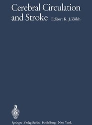 Cerebral Circulation and Stroke