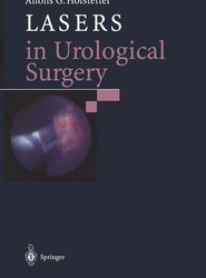 Lasers in Urological Surgery