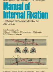 Manual of Internal Fixation