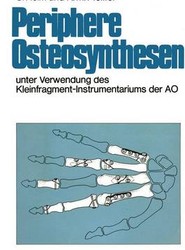Periphere Osteosynthesen