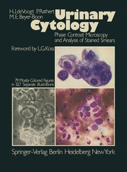 Urinary Cytology