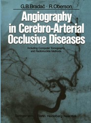 Angiography in Cerebro-Arterial Occlusive Diseases
