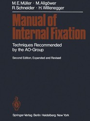 Manual of Internal Fixation