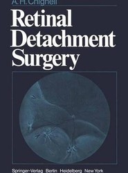 Retinal Detachment Surgery
