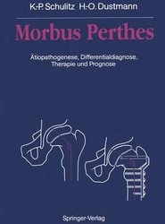 Morbus Perthes