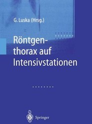 Rontgenthorax auf Intensivstationen