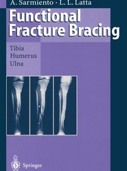 Functional Fracture Bracing