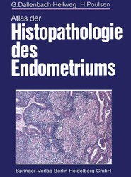 Atlas der Histopathologie des Endometriums