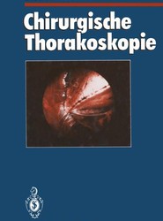 Chirurgische Thorakoskopie