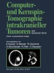 Computer- und Kernspin-Tomographie intrakranieller Tumoren aus klinischer Sicht