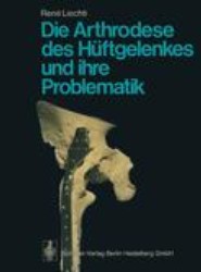 Die Arthrodese des Huftgelenkes und ihre Problematik
