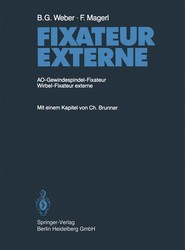 Fixateur Externe