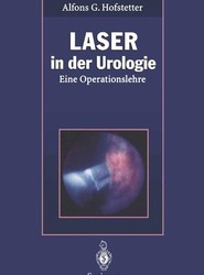 Laser in der Urologie