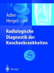 Radiologische Diagnostik der Knochenkrankheiten