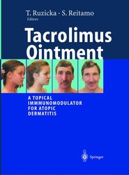 Tacrolimus Ointment