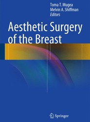 Aesthetic Surgery of the Breast