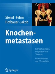 Knochenmetastasen