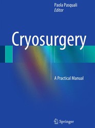 Cryosurgery