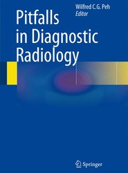 Pitfalls in Diagnostic Radiology