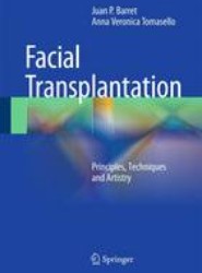 Face Transplantation