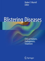 Blistering Diseases