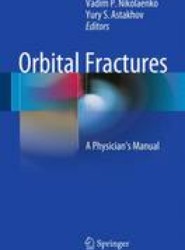Orbital Fractures