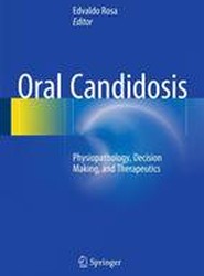 Oral Candidosis