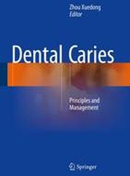 Dental Caries