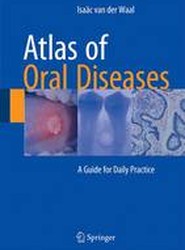 Atlas of Oral Diseases
