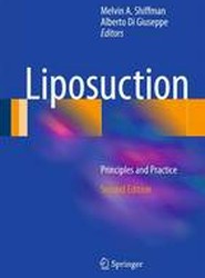 Liposuction