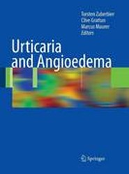 Urticaria and Angioedema