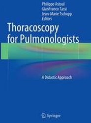 Thoracoscopy for Pulmonologists