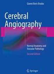 Cerebral Angiography