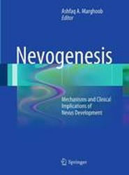 Nevogenesis