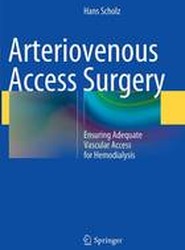 Arteriovenous Access Surgery
