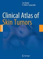 Clinical Atlas of Skin Tumors