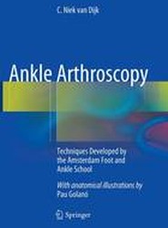 Ankle Arthroscopy