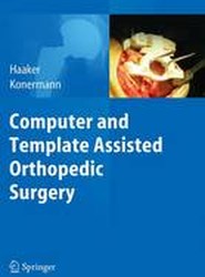Computer and Template Assisted Orthopedic Surgery
