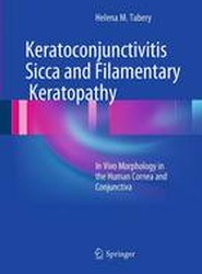 Keratoconjunctivitis Sicca and Filamentary Keratopathy