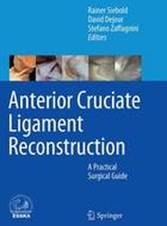 Anterior Cruciate Ligament Reconstruction